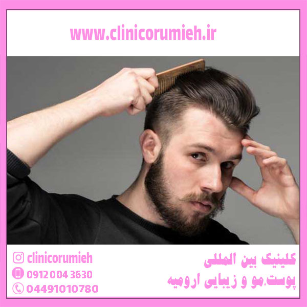 بهترین مرکز کلینیک پزشکی کاشت مو در ارومیه کجاست؟